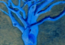 My Blue Tree
