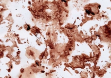 menstrual blood picture no 4