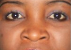 Eyes Tell Story