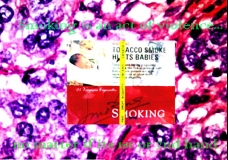 Dont smoke