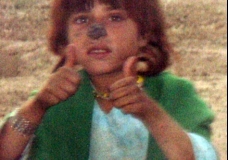 Girl With Leishmaniases
