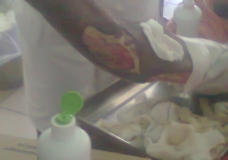 soin du pied
