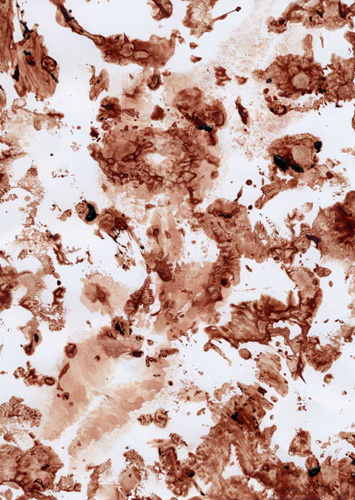 menstrual blood picture no 4