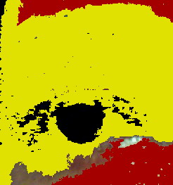 Eye