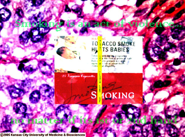 Dont smoke