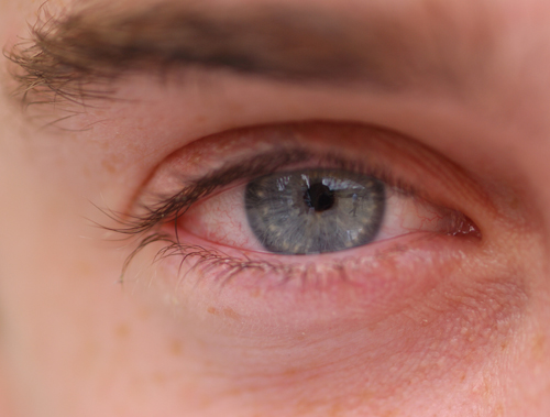 Eye reflections