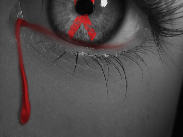 Againts HIV AIDS