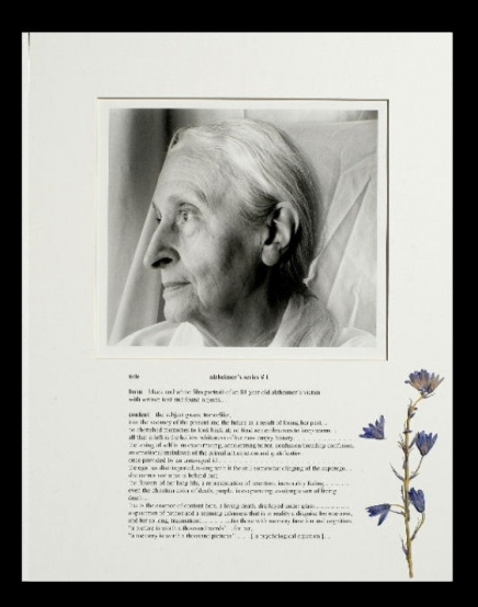alzheimer's series 1-4