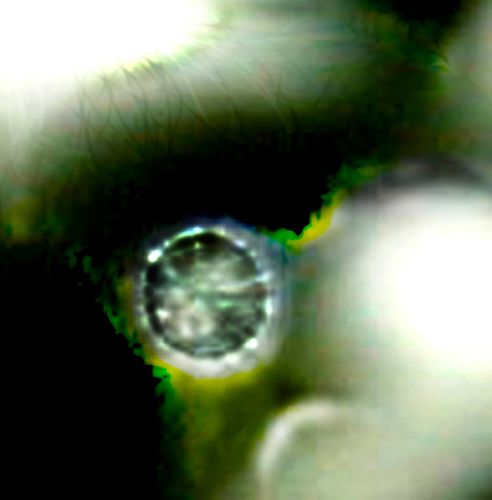 Embryo