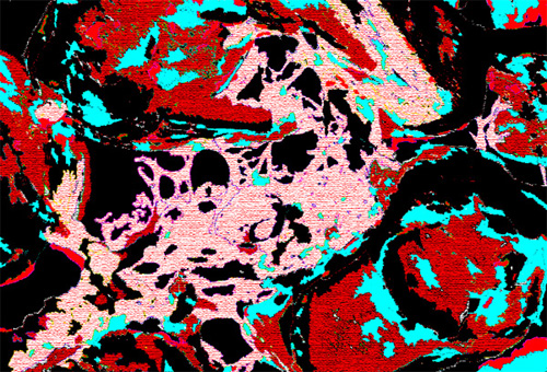 Tapestry