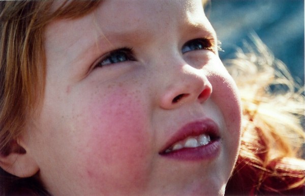 Sweet cheeks